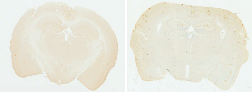 Healthy brain vs brain with A-beta plaques – photo courtesy of Jaime Ross