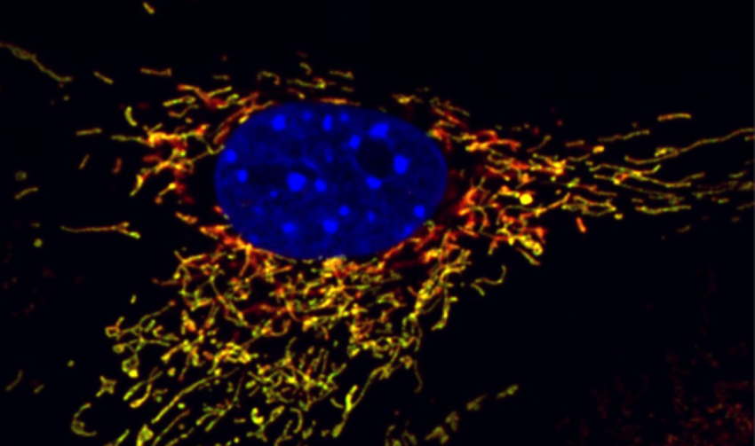 Mitochondrial network surrounding nucleus (mitoTimer)
